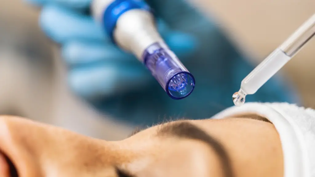 Protocole et précautions pour une séance de microneedling maison réussie, utilisation serum microneedling