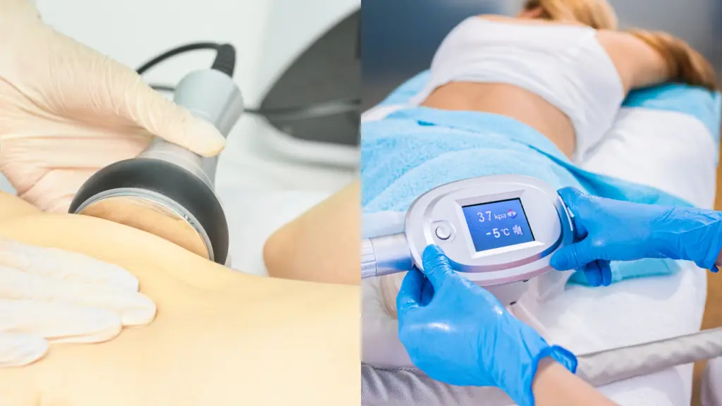 avis sur le coolsculpting vs lipocavitation avis